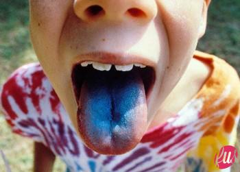 BlueTongue-1