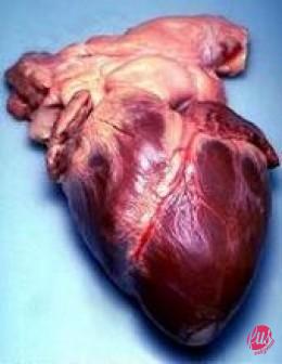 Real-Human-Heart
